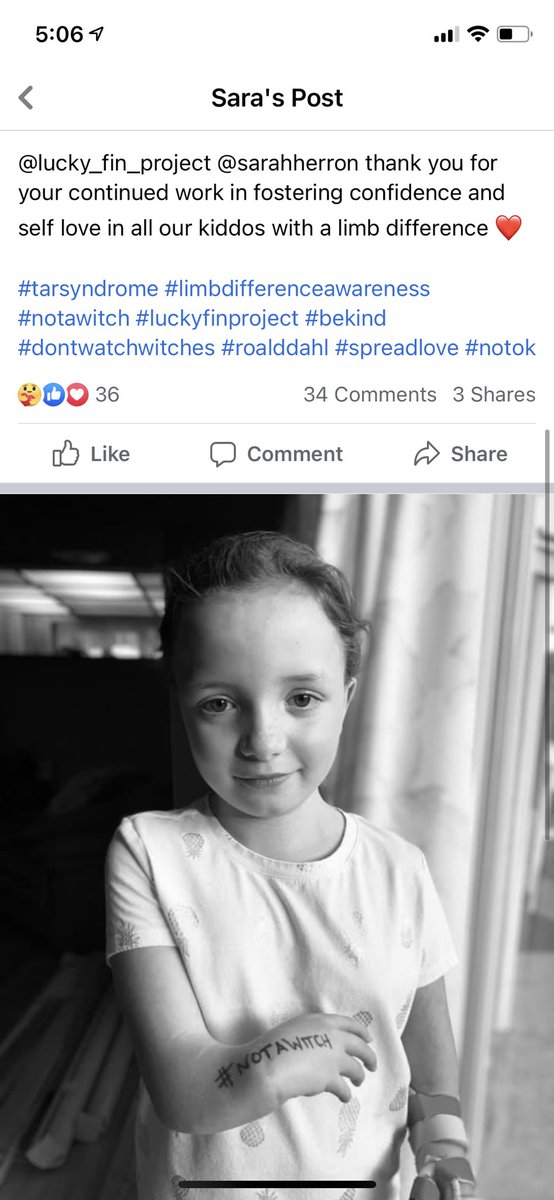 Photo of a young girl with a limb difference. On her arm she has the hash tag not a witch