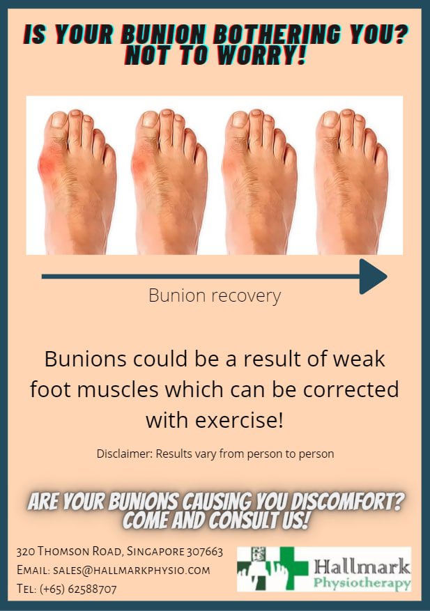 HallmarkPhysio's tweet image. Are your bunions causing you discomfort? Come and consult us!