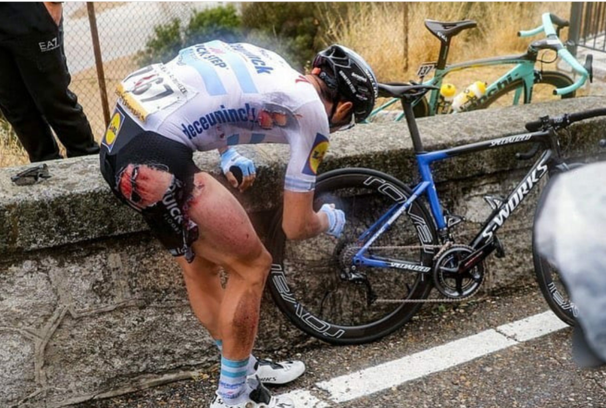 自転車 で 転ん だ 傷