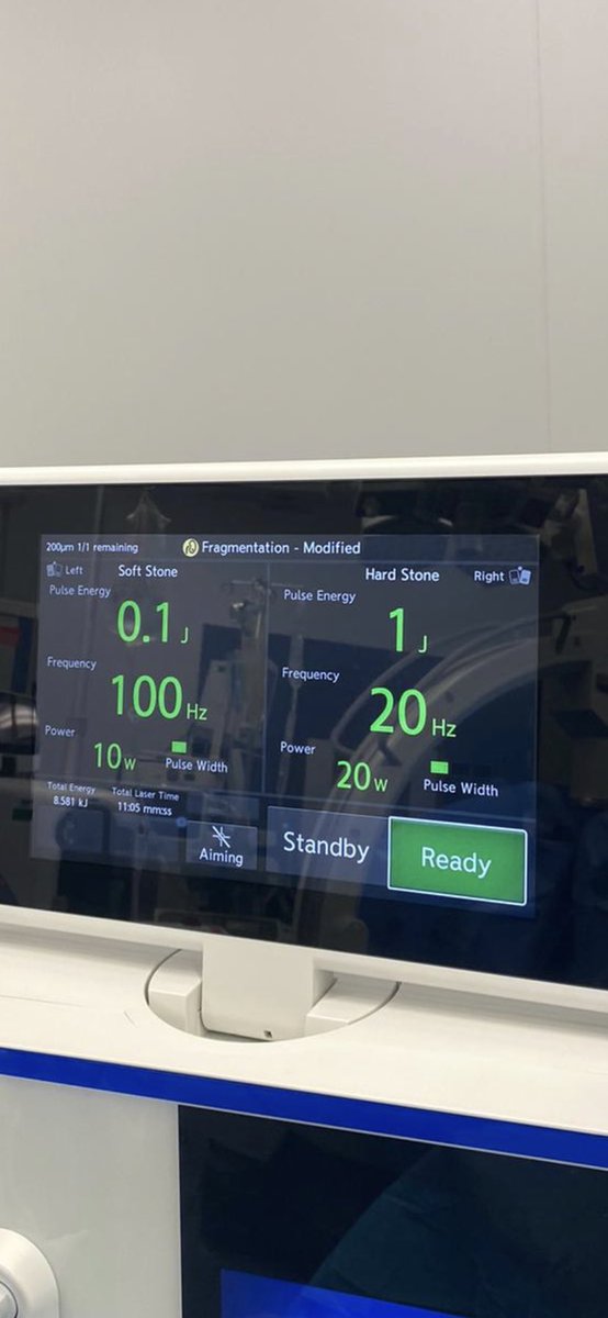 OJWiseman's tweet photo. @exkeller @JYLeeUro @GoumasUrologia @OlympusUrology @OTRAXER @YAUEndourology Had an excellent day with the #Soltive laser yesterday. I was worried it would not live up to expectations. It certainly met them. Very efficient. It seemed to vapourise most of the stone. It was dusting or super dusting. The best setting for me was 0.1 and 100hz. 1/2 https://t.co/wcVDFjasB9