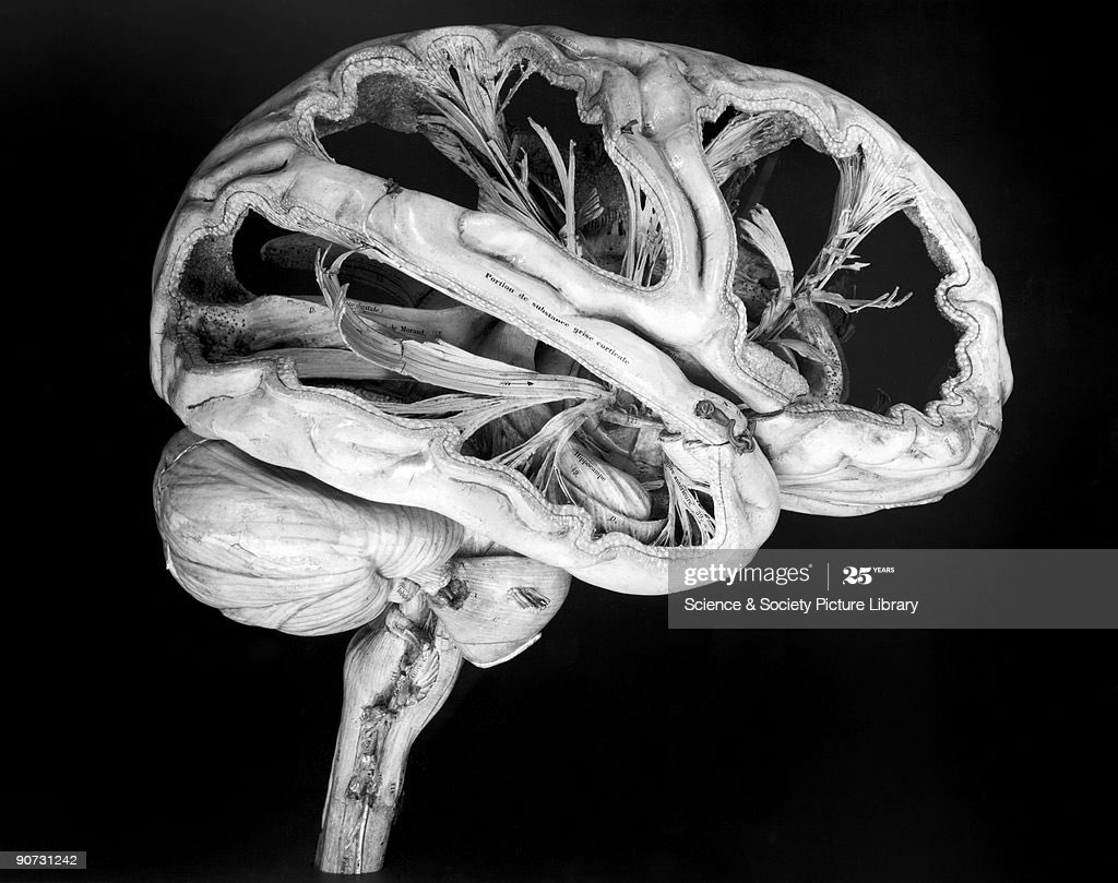 FdeCastroS's tweet photo. A la vista del razonamiento de bastantes,su cerebro,más que #GreyMatter (#SustanciaGris) lo que tiene es #BueyMatter o,como mucho #GreiMatter: así nos va.
La #telebasura hace el resto.
Eppur...¡#VivaLaInteligencia...!
Y...hagamos lo posible por #leer,#pensar y NO ser #sectarios. https://t.co/oSDI9c1imK