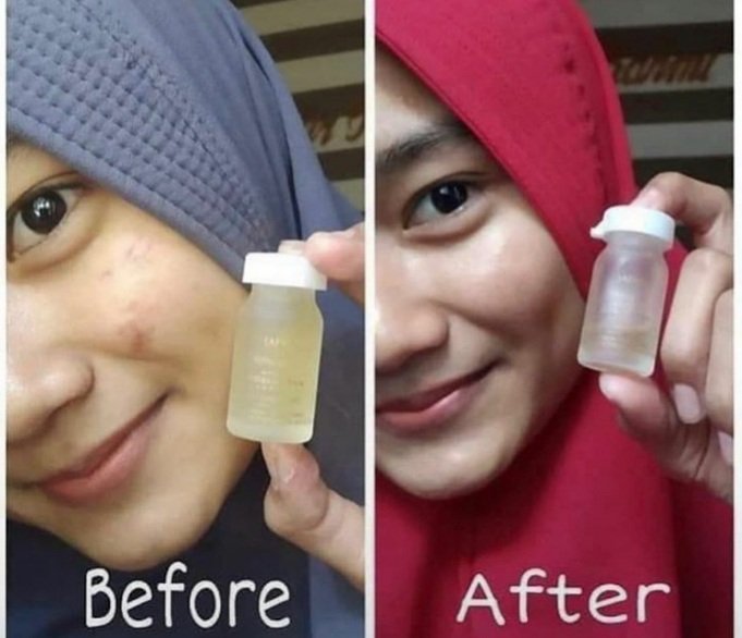Testimoni serum royaljelly kecilkecil cabe rawit 😍😍😍😍