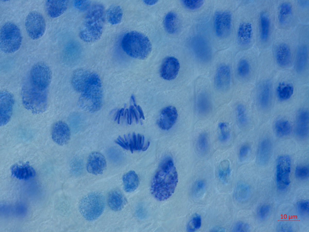 Last formal lab today for my microscopy class BI545 before projects begin in earnest. Throwback lab on mitosis using garlic and onion root tips. A few images from a previous semester. #cellbiology #microscopy #mitosis