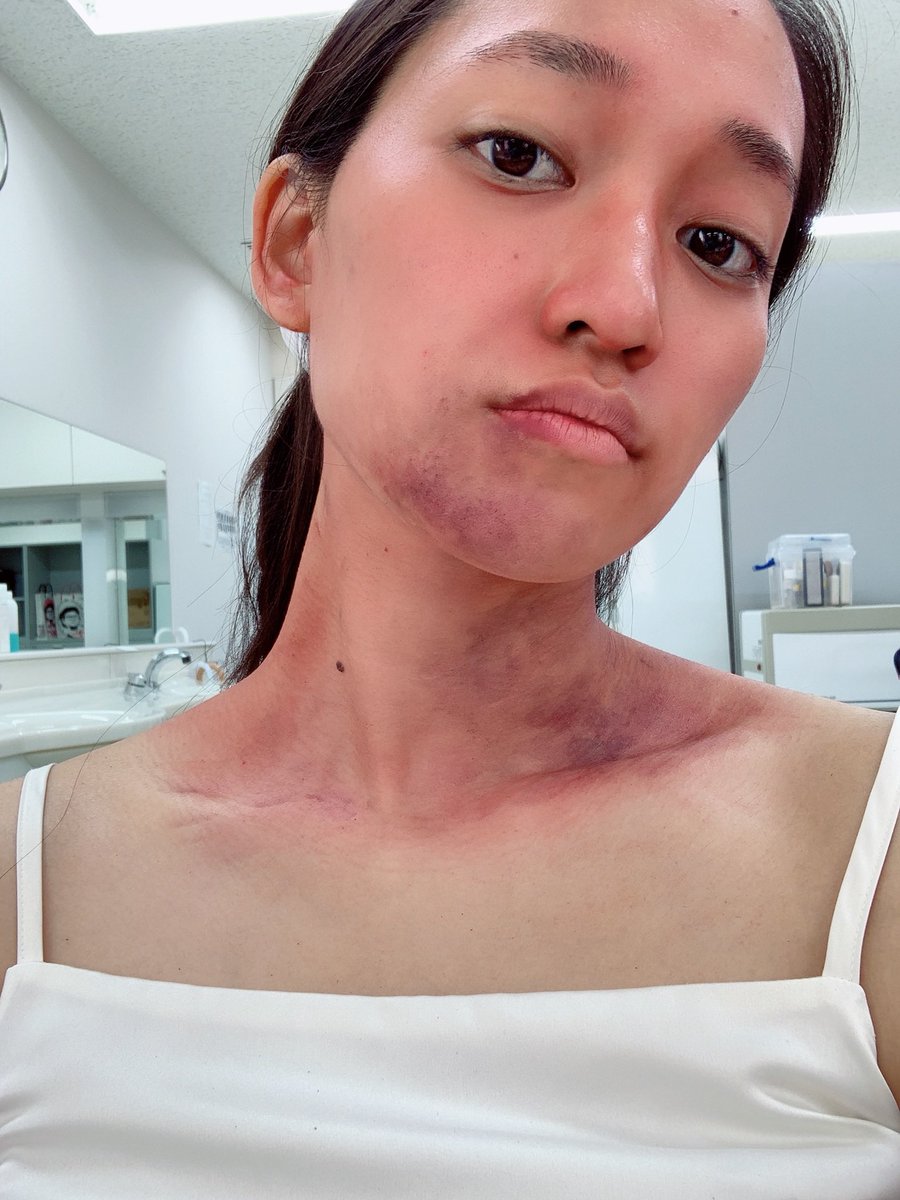 Mizuho Fuku 監察医朝顔 ご覧いただけましたか 私も佐藤絵里という被害者として 少しだけ出させていただいていました 少しですが撮影に参加させていただき とても嬉しく 勉強になりました ぜひ最終話まで楽しくご覧ください これは被害者メイク