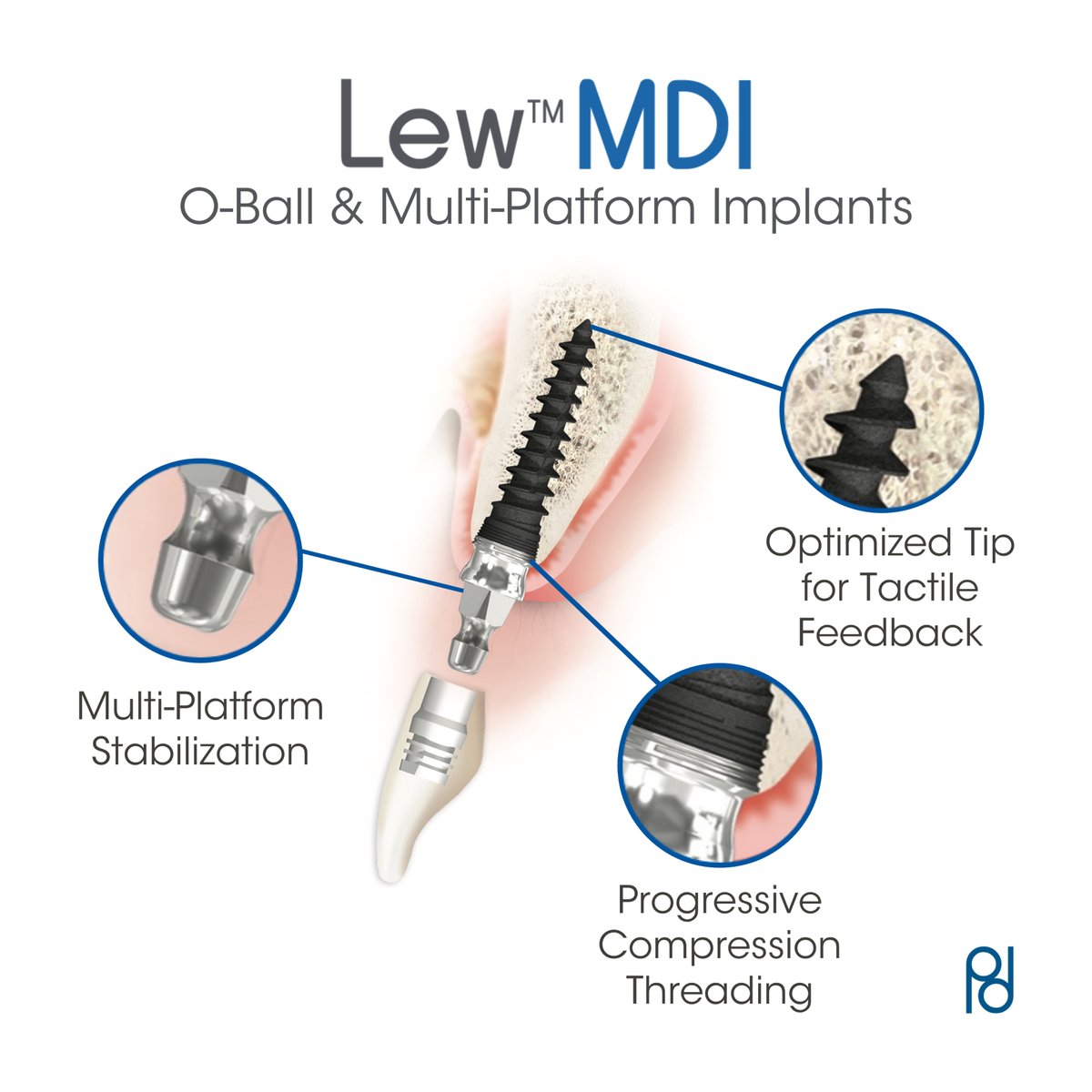 parkdentalcorp's tweet image. We developed the Lew™ MDI system to supplement traditional implants and prevent tissue
migration. Our O-ball and multi-platform implants are suitable for dense and softer bone.
#dentalimplants
#implantsystem
#teethimplants #implants
#lewmdi
#mdi #minidentalimplants
#lewimplants