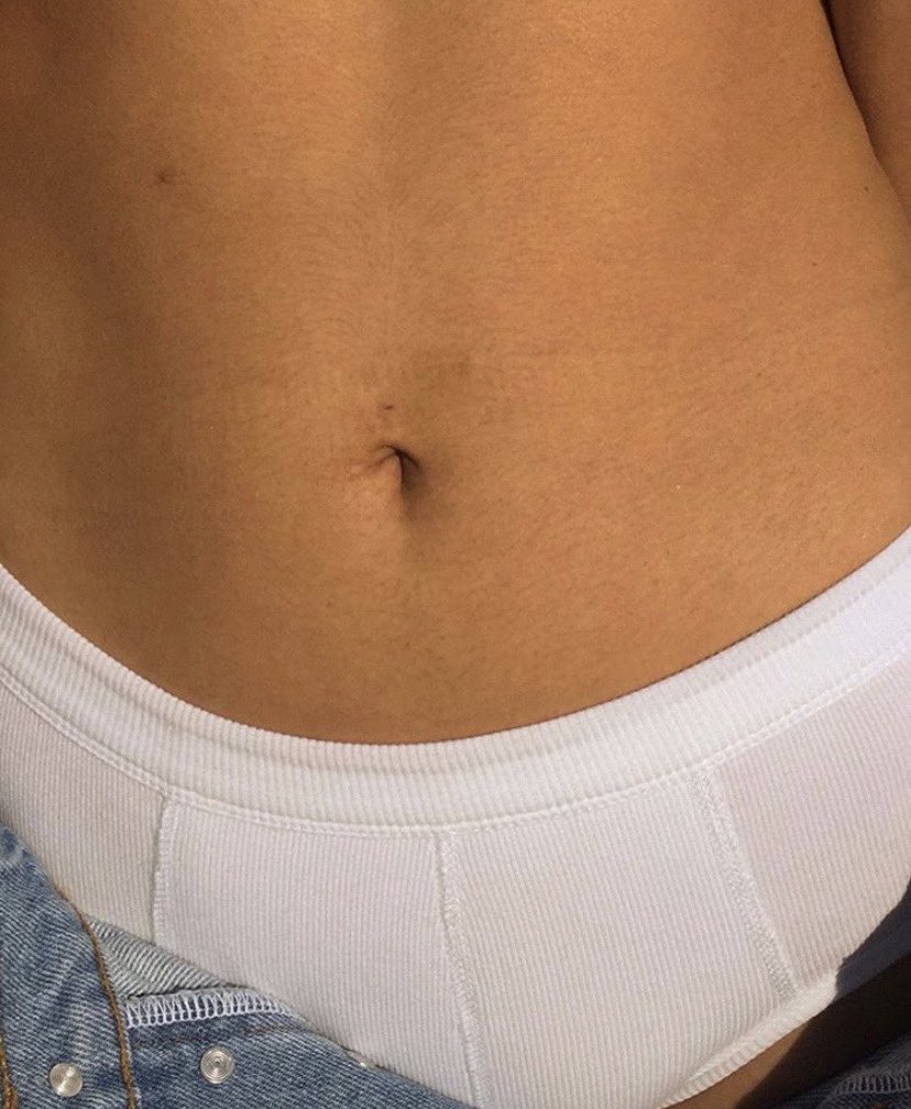 Maintaining a smooth bikini line after bikini season is all about consistency! 
Healthy skin is more of a "made over time" than "made overnight" thing 🕑

Create your perfect routine with our memberships: fuzzwaxbar.com/en/memberships/