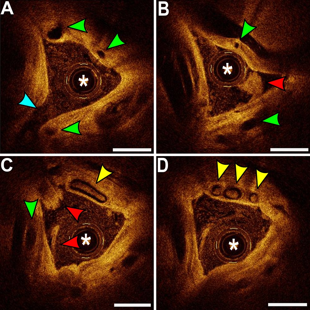 Journal of Neurosurgery tweet media