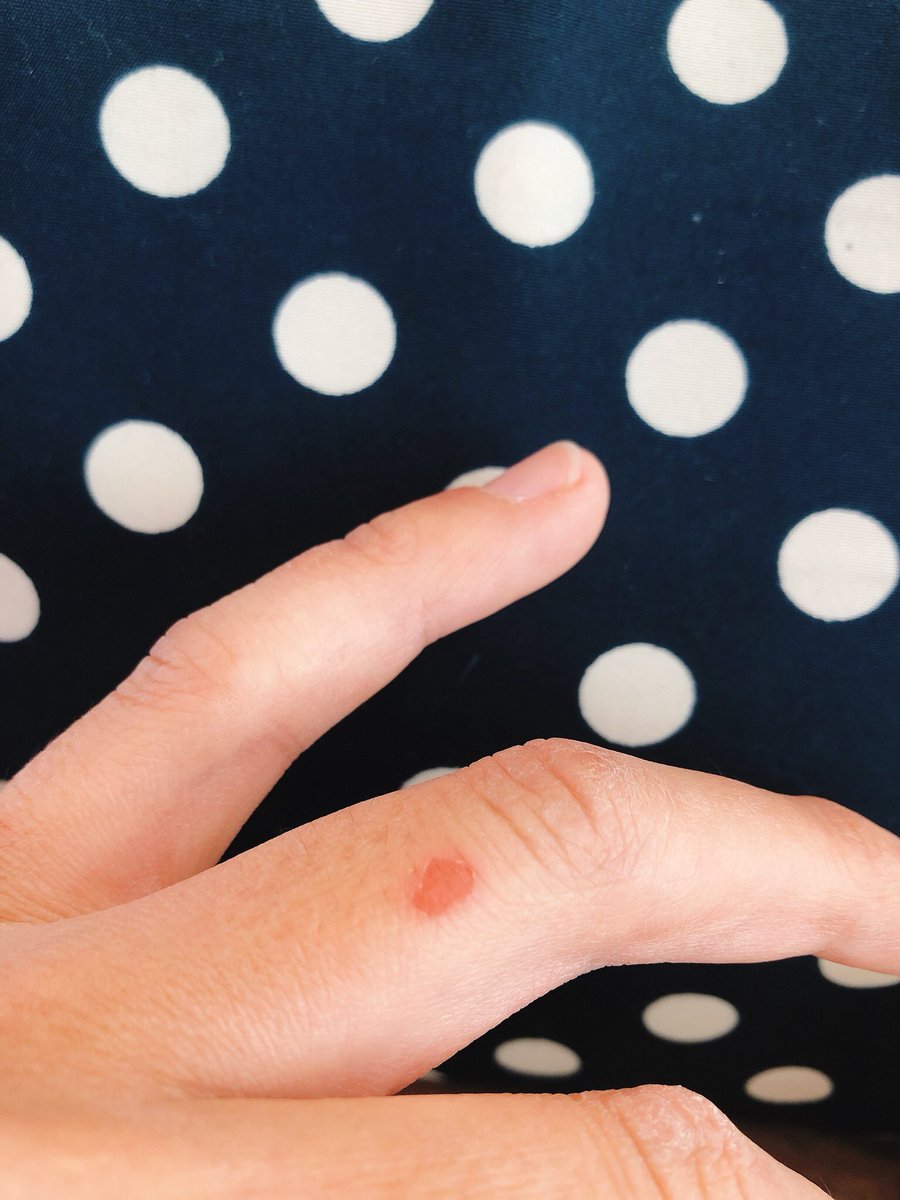 みっきー ミニボートのエギングの最適解出たわ 昨日安いshimanoのソルティアドバンスっていうアジングロッド持って行ってルビアスltの2500番fcと合わせたけど しゃくり易すぎて最高やった しゃくりすぎて指の皮剥けたから次からグローブしようと思った