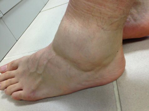 PasionAnatomia tweet picture