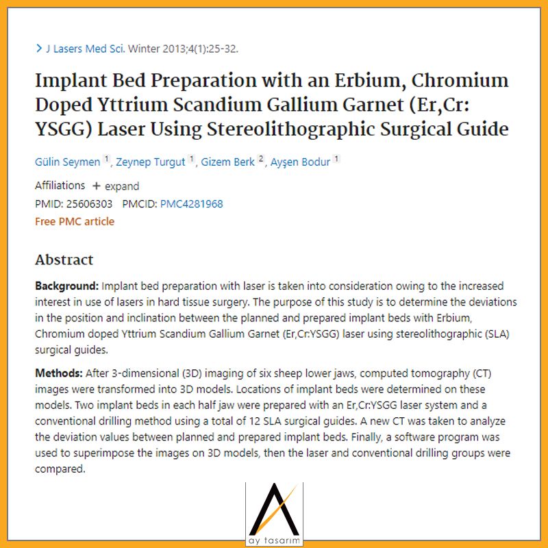aytasarim's tweet photo. Çalışma Adı: Implant Bed Preparation with an Erbium, Chromium Doped Yttrium Scandium Gallium Garnet (Er,Cr: YSGG) Laser Using Stereolithographic Surgical Guide
Doktor Adı: Gülin SEYMEN, Zeynep TURGUT, Gizem BERK, Ayşen BODUR
#Laser #Surgery #ComputerAssisted #StresAnalizi https://t.co/LyGj1bFfJa