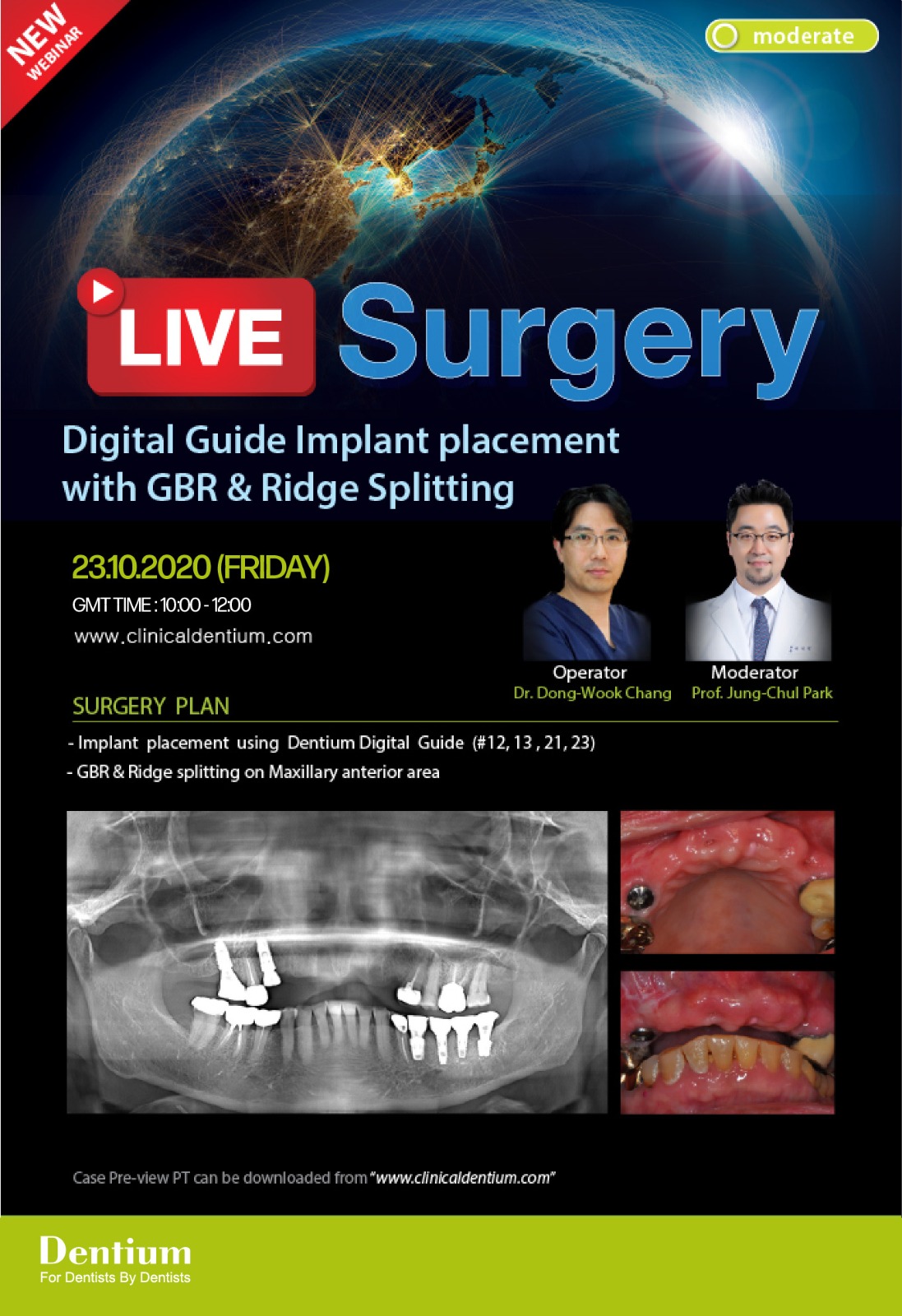 Dentium Implant Bahrain (DentiumBahrain) / Twitter