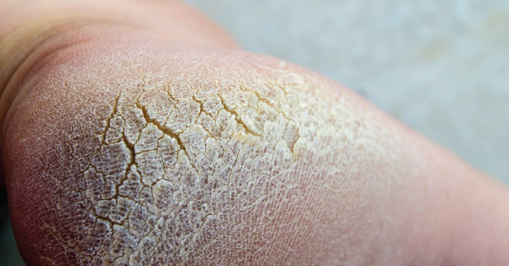 Jill Clarey Jillsnatpath Twitter