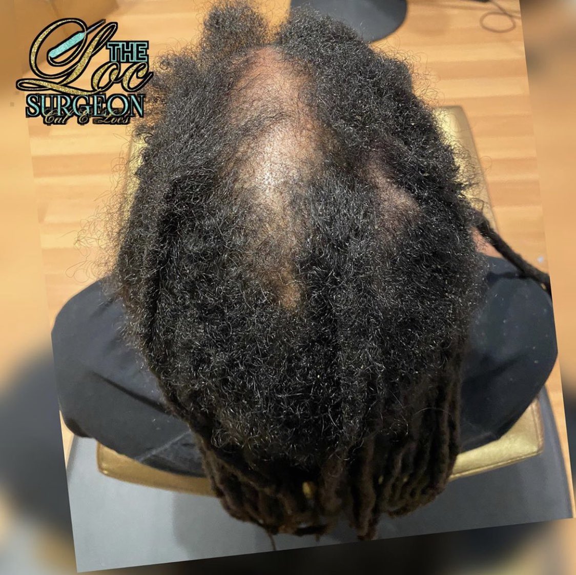 locs_e's tweet photo. Repair of Thinning Locs👏🏾 Please remember: repairing and restoring is a journey within itself.... That Loc Life is one day at a time😌 #locsurgeon #locs #757locs #locrepair https://t.co/CwvaAtsa6X