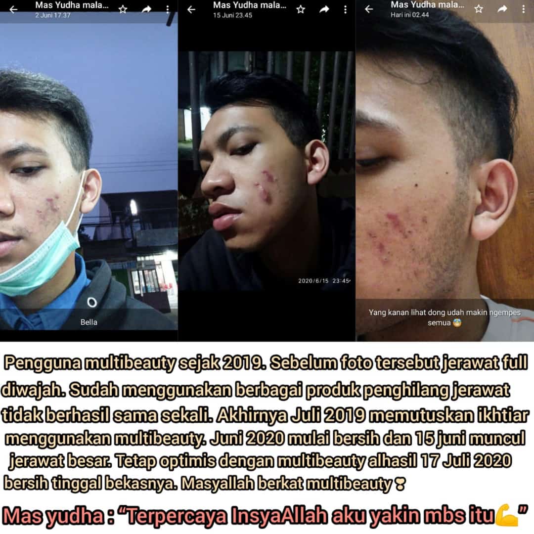LESTARIIHOKY's tweet photo. OPEN RESELLER DAN MEMBER SEBANYAK BANYAK NYA!!!  😍

Sabun Terbaik Atasi Berbagai Masalah, WAJIB COBAIN!✨😘 Sabun Multifungsi dan Bermanfaat! Sehat dan Mulus bisa didapatkan dengan mudah😍😍

Hanya dengan sabun, NO RIBET ❌❌ https://t.co/8klaRw9bmP