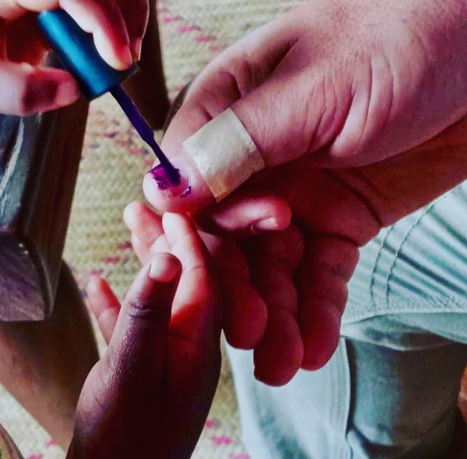 mikeinuganda's tweet photo. Apparently - according to my daughter - the best thing for a cut thumb is purple nail polish... who knew ? #miraclecure #fatherofadaughter #rubylicious https://t.co/JcYZVormyu