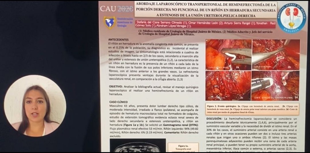 Urología Hospital Juárez de México 🇲🇽 tweet media
