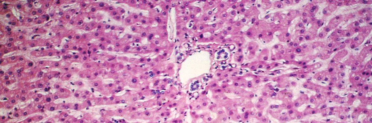 Science Immunology (@sciimmunology) on Twitter photo In #human liver tissue, <a href="/StaryGeorg/">Georg Stary</a> and @MedUni_Vienna, <a href="/oeaw/">Austrian Academy of Sciences</a> scientists identified a natural killer cell population – considered part of the innate #immune system – that can adopt adaptive immune functions, such as recall responses to foreign invaders: fcld.ly/lhu9hym In #human liver tissue, <a href="/StaryGeorg/">Georg Stary</a> and @MedUni_Vienna, <a href="/oeaw/">Austrian Academy of Sciences</a> scientists identified a natural killer cell population – considered part of the innate #immune system – that can adopt adaptive immune functions, such as recall responses to foreign invaders: fcld.ly/lhu9hym