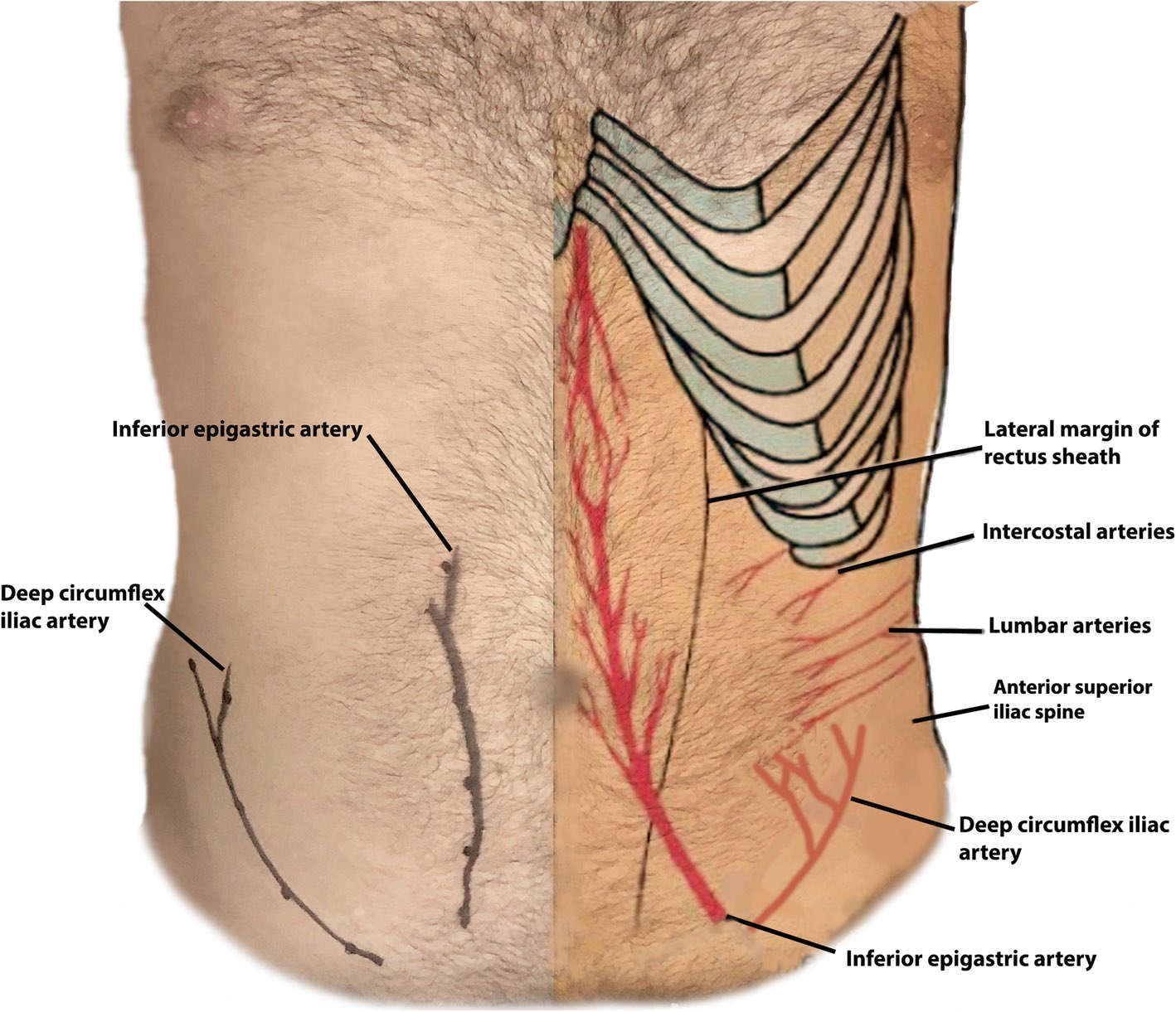 Superior Epigastric Artery
