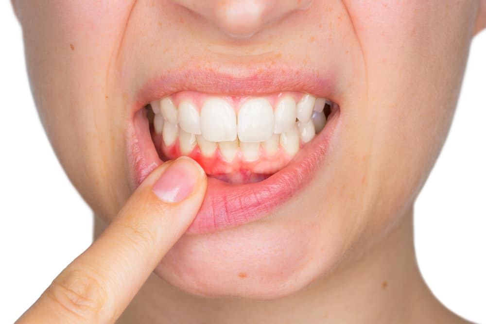 Can keeping your gums healthy improve overall health? Check our <a href="/JDentRes/">Journal of Dental Research</a> #SystematicReview from <a href="/FSPH_IU/">Fairbanks School of Public Health</a> <a href="/IUDentistry/">IU Dental School</a> + <a href="/OhioStateMed/">The Ohio State University College of Medicine</a> with @heather47582951 <a href="/tim_treat/">Tim Treat</a> <a href="/TThyvalikakath/">ThankamThyvalikakath</a> <a href="/titusschleyer/">Titus Schleyer</a> for the answer!
doi.org/10.1177%2F0022… <a href="/AmerDentalAssn/">ADA</a> <a href="/PerioNews/">AAP</a> <a href="/Regenstrief/">Regenstrief Institute, Inc.</a>