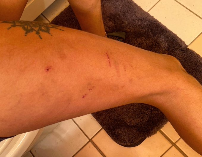 in honor of domestic violence awareness month and fostering queer/WLW visibility, even (or especially)<a href="/tag/genderfluid"class="tags"><span>#genderfluid</span></a><a href="/tag/agender"class="tags"><span>#agender</span></a><a href="/tag/nonbinary"class="tags"><span>#nonbinary</span></a><a href="/tag/qpoc"class="tags"><span>#qpoc</span></a><a href="/tag/bipoc"class="tags"><span>#bipoc</span></a>