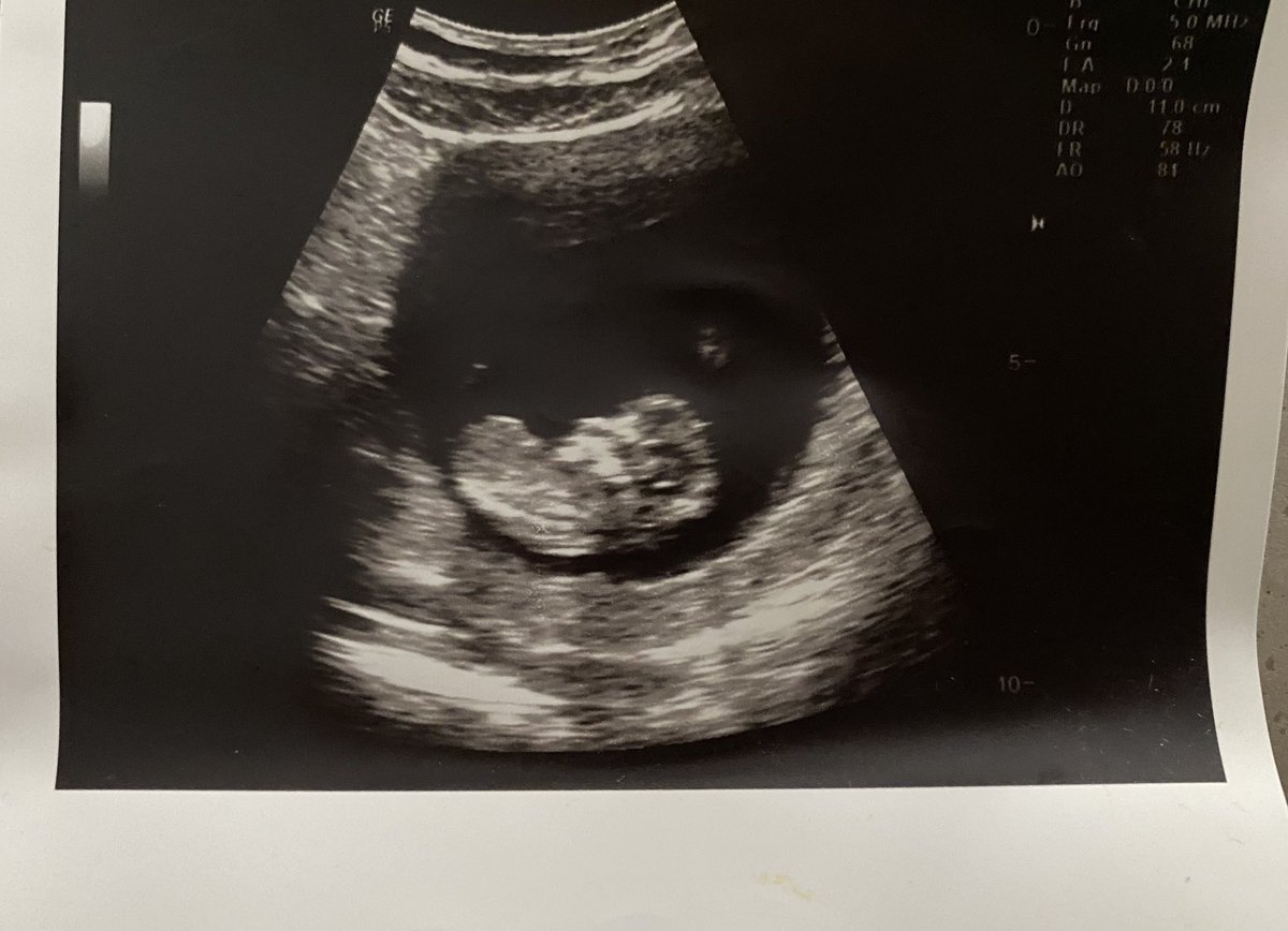 MAXMusic's tweet photo. HOW IT STARTED : HOW ITS GOING 

(CANT WAIT TO MEET YOU MY LITTLE LOVE) https://t.co/lzCioBSbe2