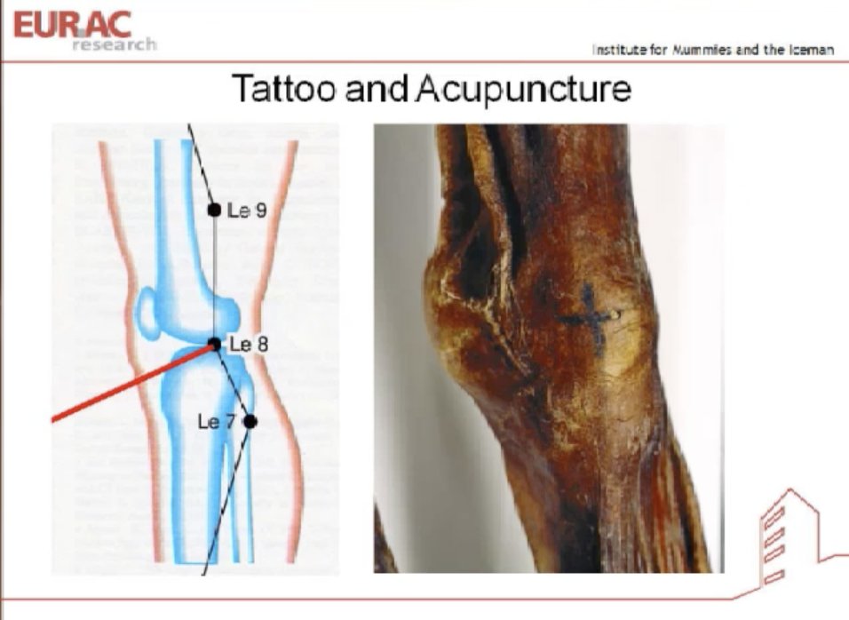 Interestingly, he has small, linear tattoos in the places where he would have experienced arthritic pain, showing that perhaps these people used a type of acupuncture to alleviate pain.