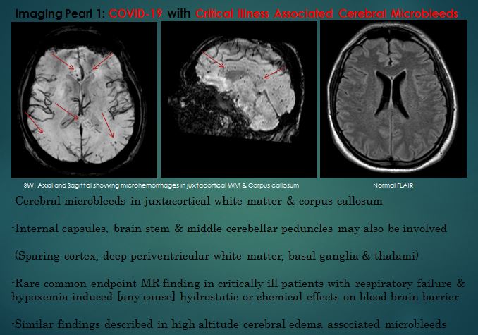 Surjith Vattoth tweet media