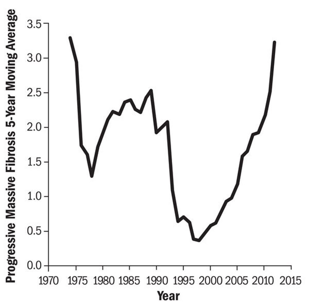 Did you know that the incidence of Black Lung is increasing again?It is—Progressive Massive Fibrosis in particular (which is a whole ‘nother thread for another time).  https://www.cdc.gov/niosh/updates/upd-07-20-18.html