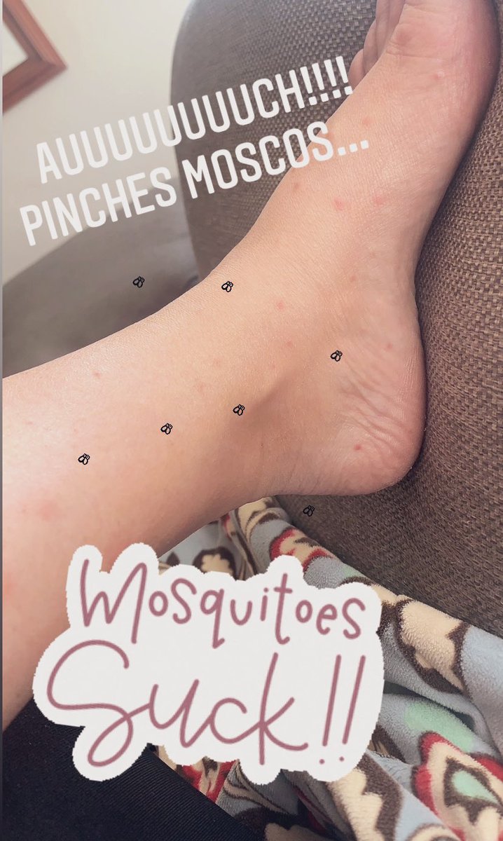 KYOCR's tweet photo. No puedo más!!!!
Nunca me picaban y ahora me devoraron!!!! 
#putosmoscos https://t.co/CboArpxJoo