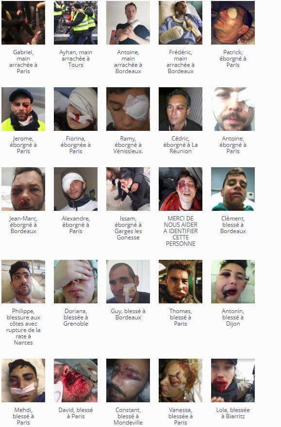 KBresnel's tweet photo. @StanGuerini Regardez ce que vous avez fait !!! Ayez ça sur la conscience jusqu'au dernier jour de votre vie !!
#PasDeLoiAvia2
#OnNEnPeutPlusDesLrem
#LremCaSuffit
#TousContreMacronJour26
#NimacronNilepen2022
#DarmaninDemission
#JLM2022
#macronEstFou https://t.co/F4iFfJ7TAc