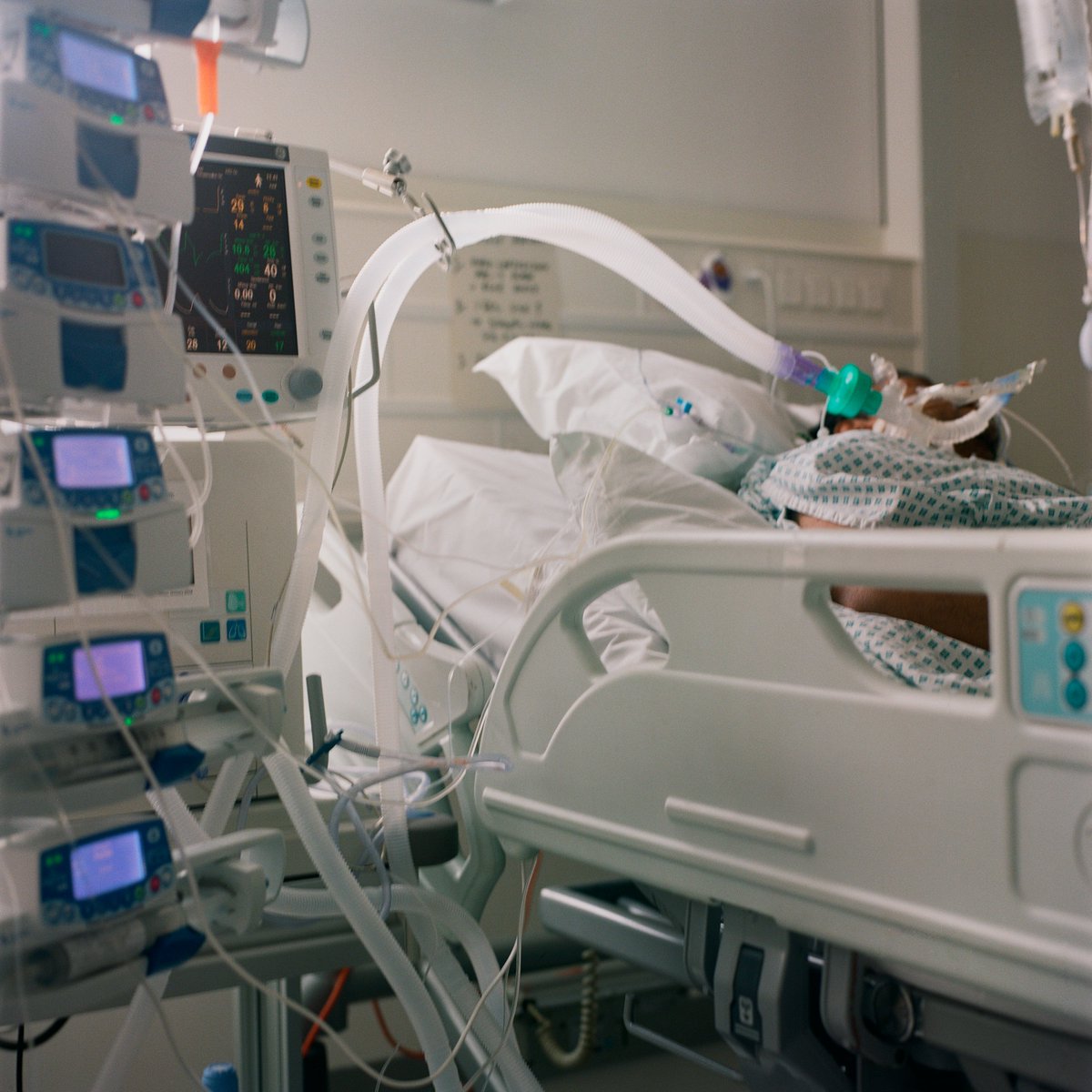 Ventilation: For very severe cases where patients cannot breathe without a machine. Patients are sedated and a tube placed in their windpipe connecting them to a ventilator. High-burden but life sustaining treatment. Needs highly trained nurses. Only used in intensive care. 15/20
