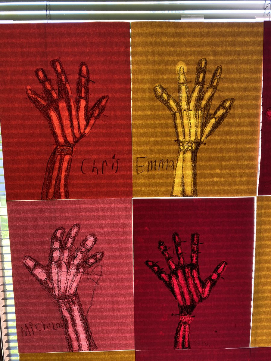 mrspassECS's tweet photo. We had fun doing a Mystery Science lesson! We learned about our bones &amp; created x-rays of our hands! https://t.co/WrGmQ5qQ8p