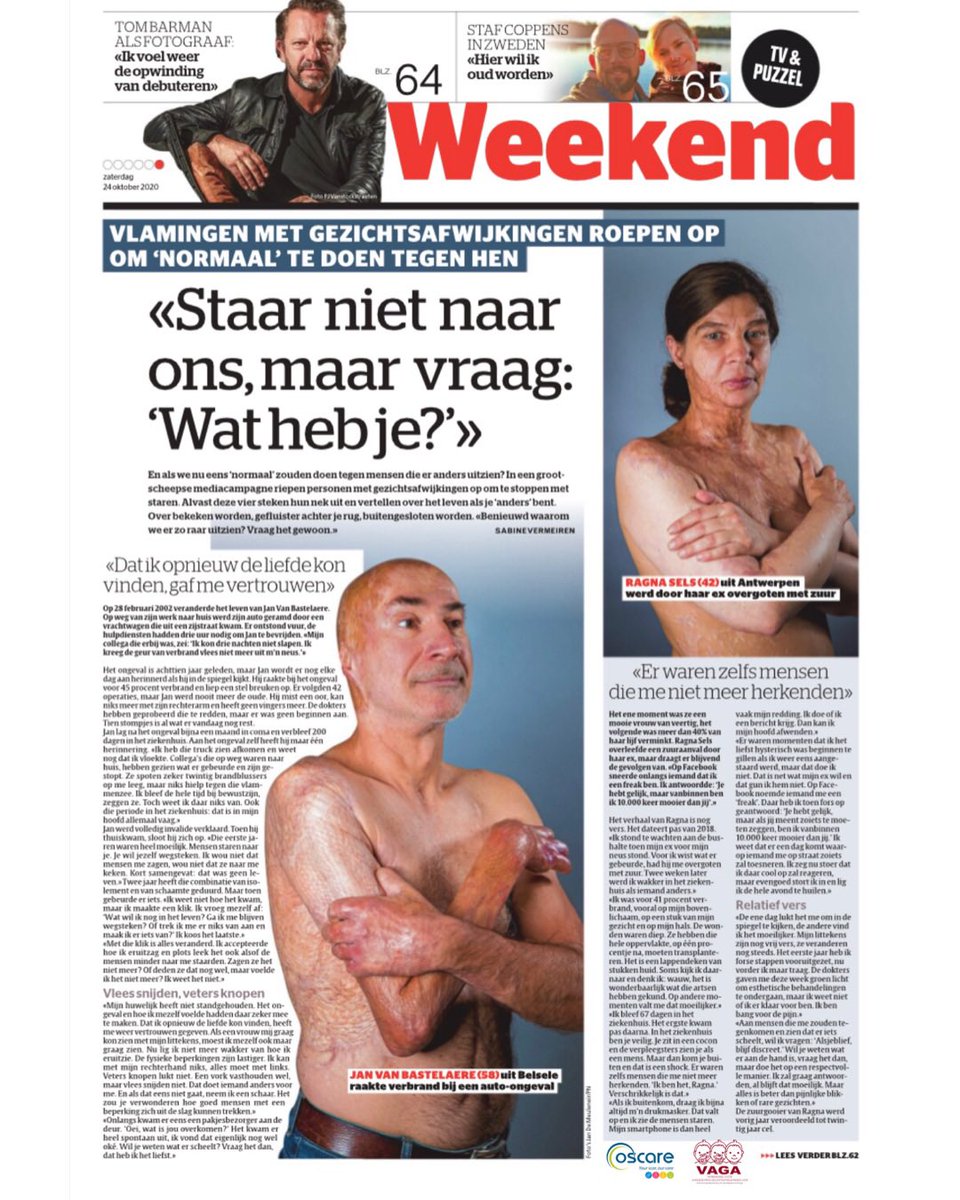 vzwOscare's tweet photo. Vandaag voorpagina weekendkrant van https://t.co/UJhkMIfM6s: Naar aanleiding van “Dit is geen kunst, maar hedendaagse realiteit!” doen Jan, Ragna, Frèderic en Evi hun verhaal. Zeker de moeite om te lezen. Stop met staren en teken... https://t.co/fybCtNVHIC. #faceequalityday https://t.co/C3JGmULrzx