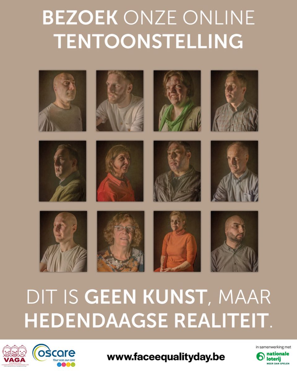vzwOscare's tweet photo. Vandaag voorpagina weekendkrant van https://t.co/UJhkMIfM6s: Naar aanleiding van “Dit is geen kunst, maar hedendaagse realiteit!” doen Jan, Ragna, Frèderic en Evi hun verhaal. Zeker de moeite om te lezen. Stop met staren en teken... https://t.co/fybCtNVHIC. #faceequalityday https://t.co/C3JGmULrzx