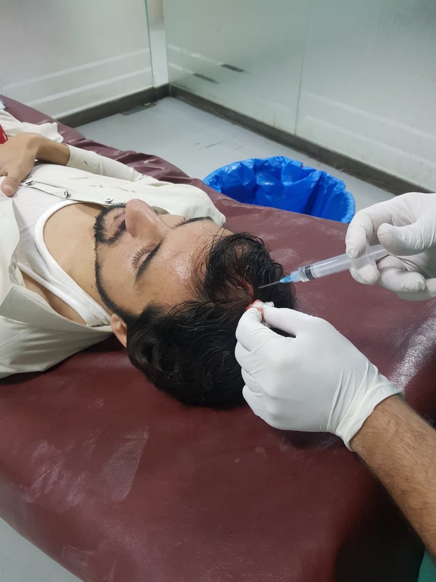 MalikHasnainA16's tweet photo. پختون سٹوڈنٹس فیڈریشن کے صوبائی چیرمین جمشید وزیر رہائی کے بعد ہسپتال میں زیر علاج ہیں 
#WeStandWithPSF https://t.co/2jIlV1izWn
