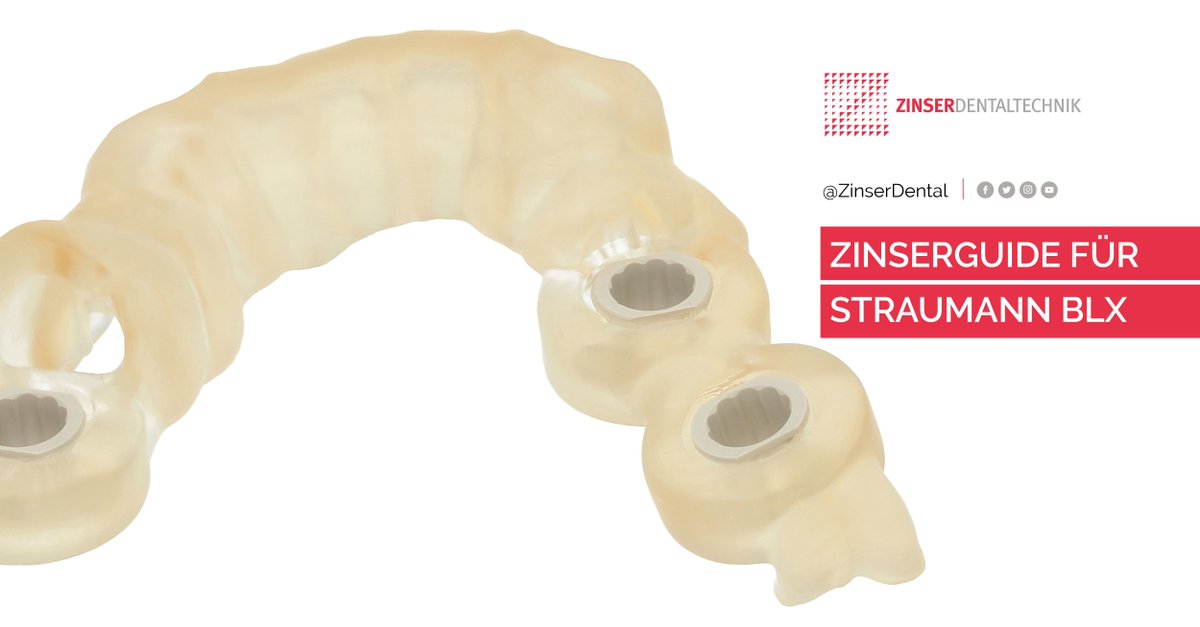 ZinserDental's tweet image. Unsere Experten fertigen digitale Prothetikentwürfe an und visualisieren die Planung in 3D. Auf Wunsch führen wir mit dir auch die gesamte Planung durch. 

#backwardplanning #zinserguide #BLX #straumann #kooldentistry