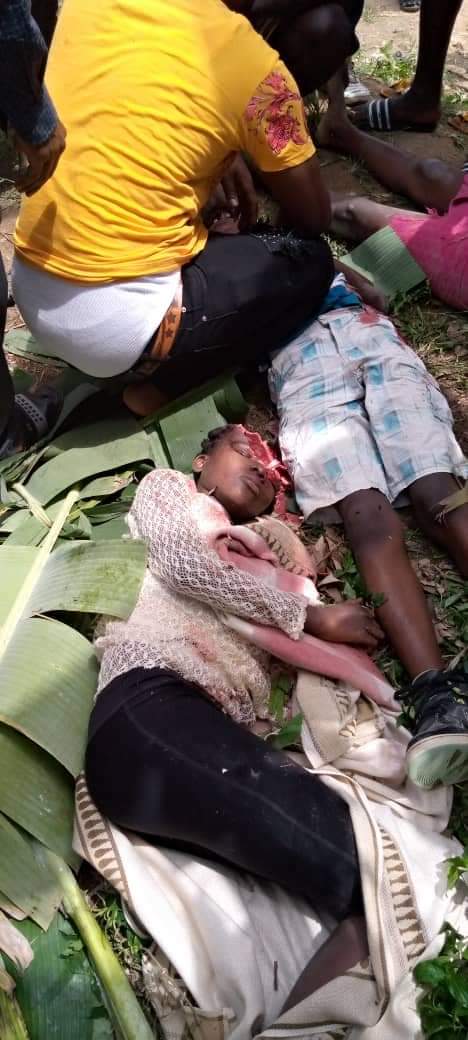 silas_atefor's tweet photo. #War_in_SouthernCameroons
The #Horrific killings of #School_Children in #Kumba/Ambazonia is yet another sad consequence of the Neglect of the Ambazonia vs Cameroun #Conflict.
How long will world leaders continue to #TurnA_BlindEye.
@AsstSecStateAF 
@SenatorCardin
@innercitypress https://t.co/4YZOaNZvRL