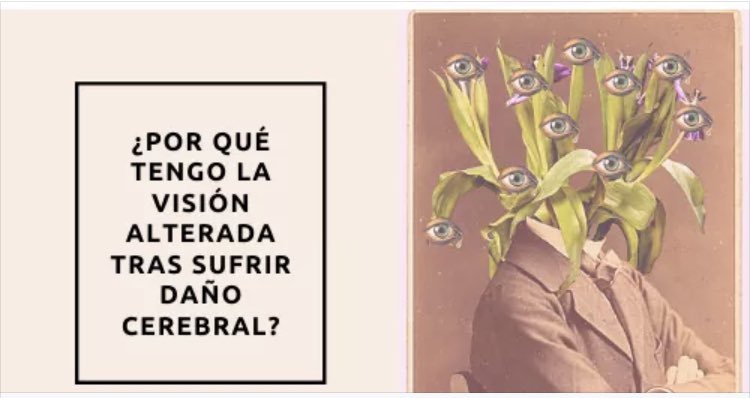 DraRubyE's tweet photo. Así le sucede a@muchos de estos pacientes, la terapia visual y la neurorehabilitacion Optometrica pueden ser de ayuda para estos pacientes..#drarubye..#drarubygaleano..#optometry https://t.co/GGC9eFQwf6