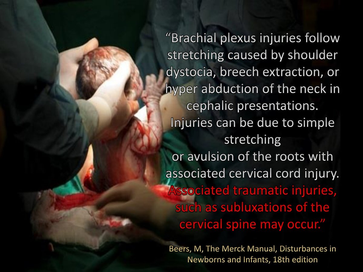 FolsomChiro's tweet photo. Did you know?
.
#folsomlifechiro #chiropractic #chiropractor #wellness #health #healthylifestyle #pregnancy #healthyliving #babies #kids https://t.co/g8wMETsy9j