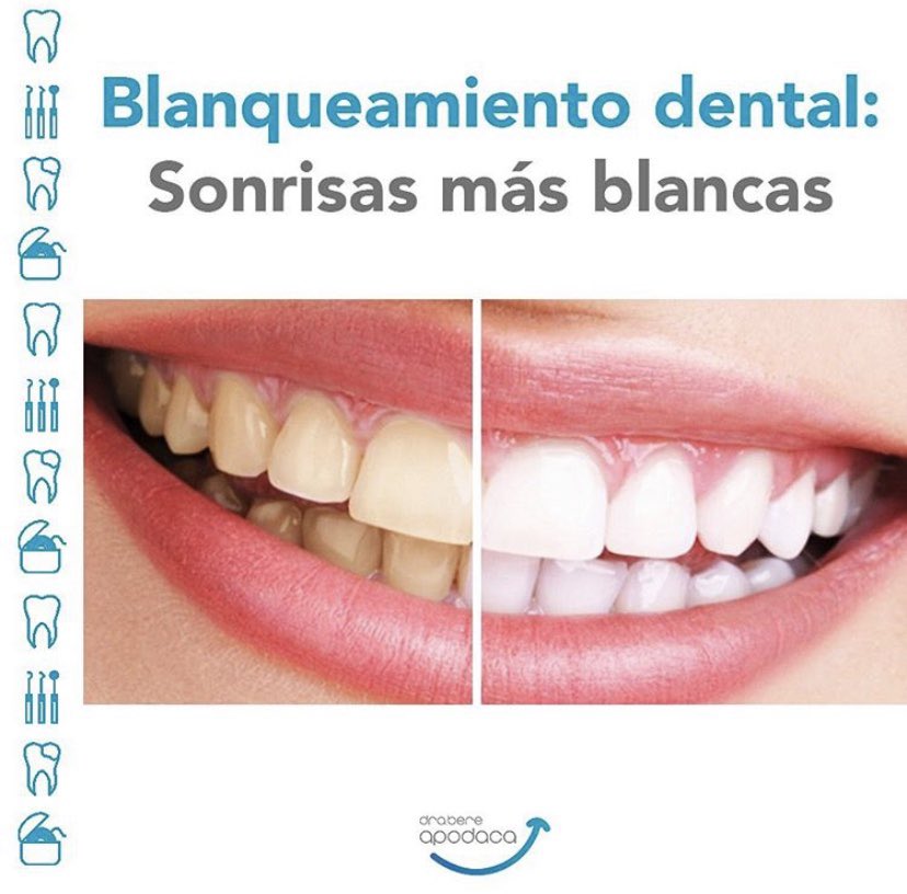 drabereapodaca's tweet photo. No hay duda de que una sonrisa resplandeciente es una gran carta de presentación. Pero, ¿sabes de qué depende el tono de los dientes y cómo podemos mejorarlo?
#diseñodesonrisas #expertosensonrisas #dentista #sonrisaperfecta #dientesperfectos
#sonrielealavida
#tipsdentales https://t.co/g9uIh7wylh