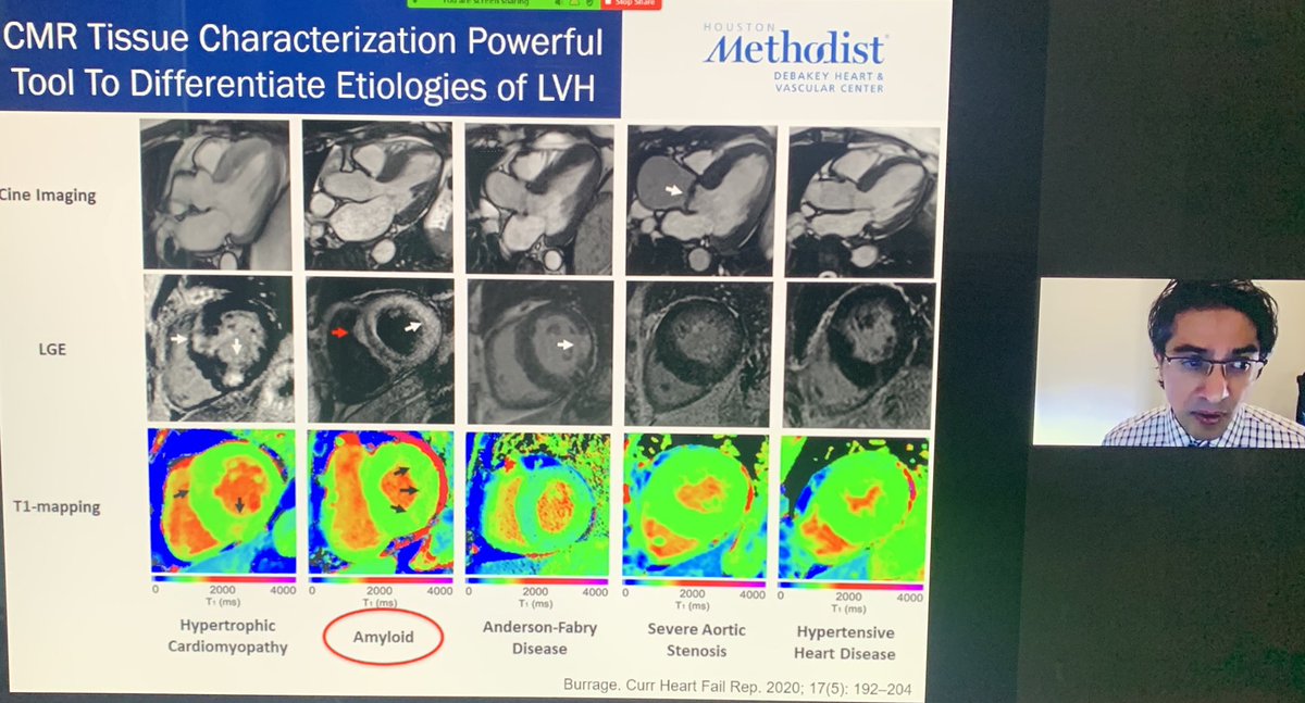 Great talk by @FNabiMD #asnc @almallahmo @bhtrachtenberg @onco_cardiology @ChamsiPash