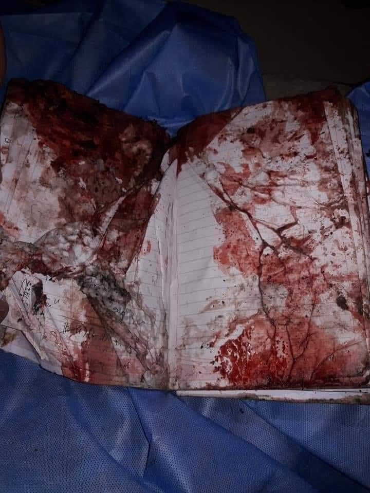 BasheerFanakzai's tweet photo. کفر دوام کوي خو ظلم دوام نه کوي!
په کتابچه پرته وینه د څو معصومو زده کوونکو ده چې د هیواد د ښه راتلوونکې لپاره یې زده کړه کوله خو  بې رحمه دښمن شهیدان کړل.
دښمن مرمۍ به ختمې شي خو زمونږ سینې نشي ختمیدای، د هیواد د ابادۍ او د نظام د ټینګښت لپاره د ځوانانو مبارزه نه ودریدونکې ده! https://t.co/h2Ibdv5AHi