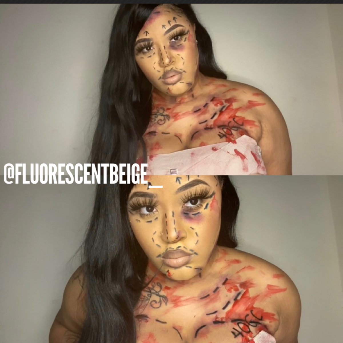 “Pretty Hurts” Day 6 #fluorescentbeiges10daysofhalloween #2020halloween #blackhalloween #halloweenmakeup #halloweenmakeup2020 #plasticsurgery #facelift  #tsr #makeupforblackwomen