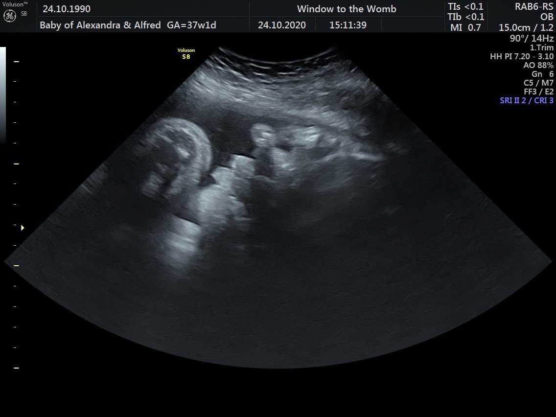 AlexClark24's tweet photo. Turning 30 not quite how I had expected it would be... but wonderful none the less 🥰Celebrating with my guy, my family, lots of food &amp; seeing our little man one last time before he arrives for good!! Couldn’t ask for anything more 💗🎉🤰🏻🎈 #30thbirthday #37weeks https://t.co/NvZx6ekbyp