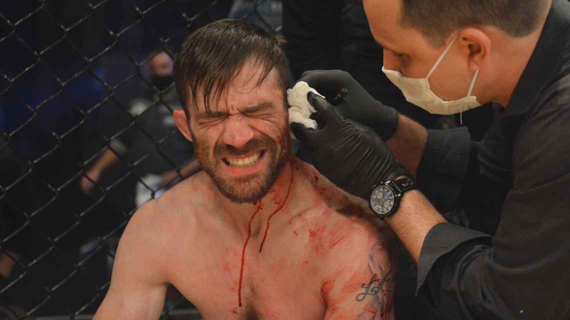 SportsCenterBR's tweet photo. IMAGENS FORTES! Brasileiro faz estrago, e americano quase perde a orelha no Taura MMA

👉 https://t.co/Fp18TP2kdU https://t.co/og5MxtMikZ