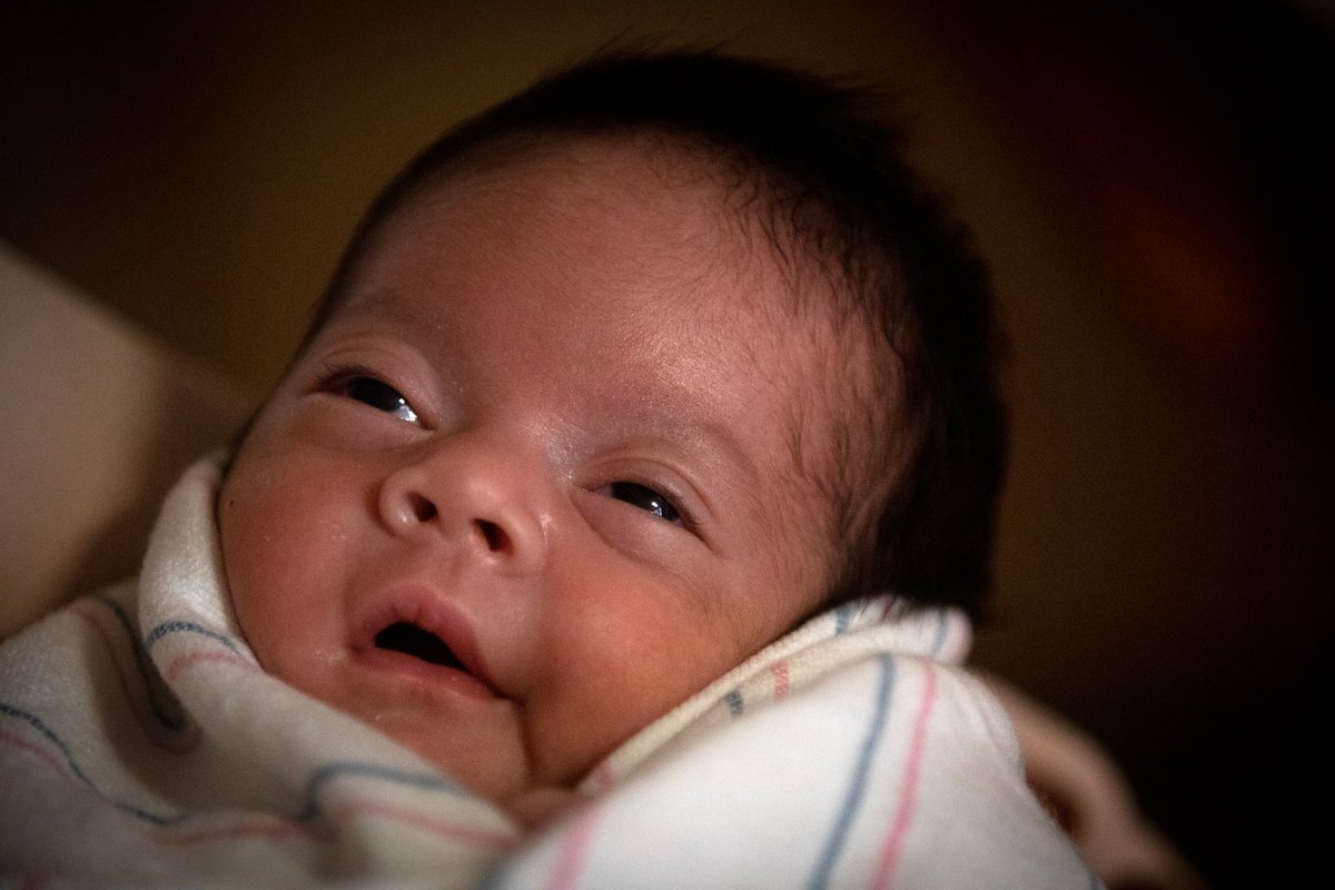 Emiliana was born July 13 — 10 weeks early, weighing 3 pounds, 6 ounces. She needed a ventilator for the first several days of her life. More than a month would pass before she felt her mother’s touch. She spent her first eight weeks in the neonatal ICU.  https://www.latimes.com/california/story/2020-10-24/pregnant-woman-with-covid-gives-birth-in-coma