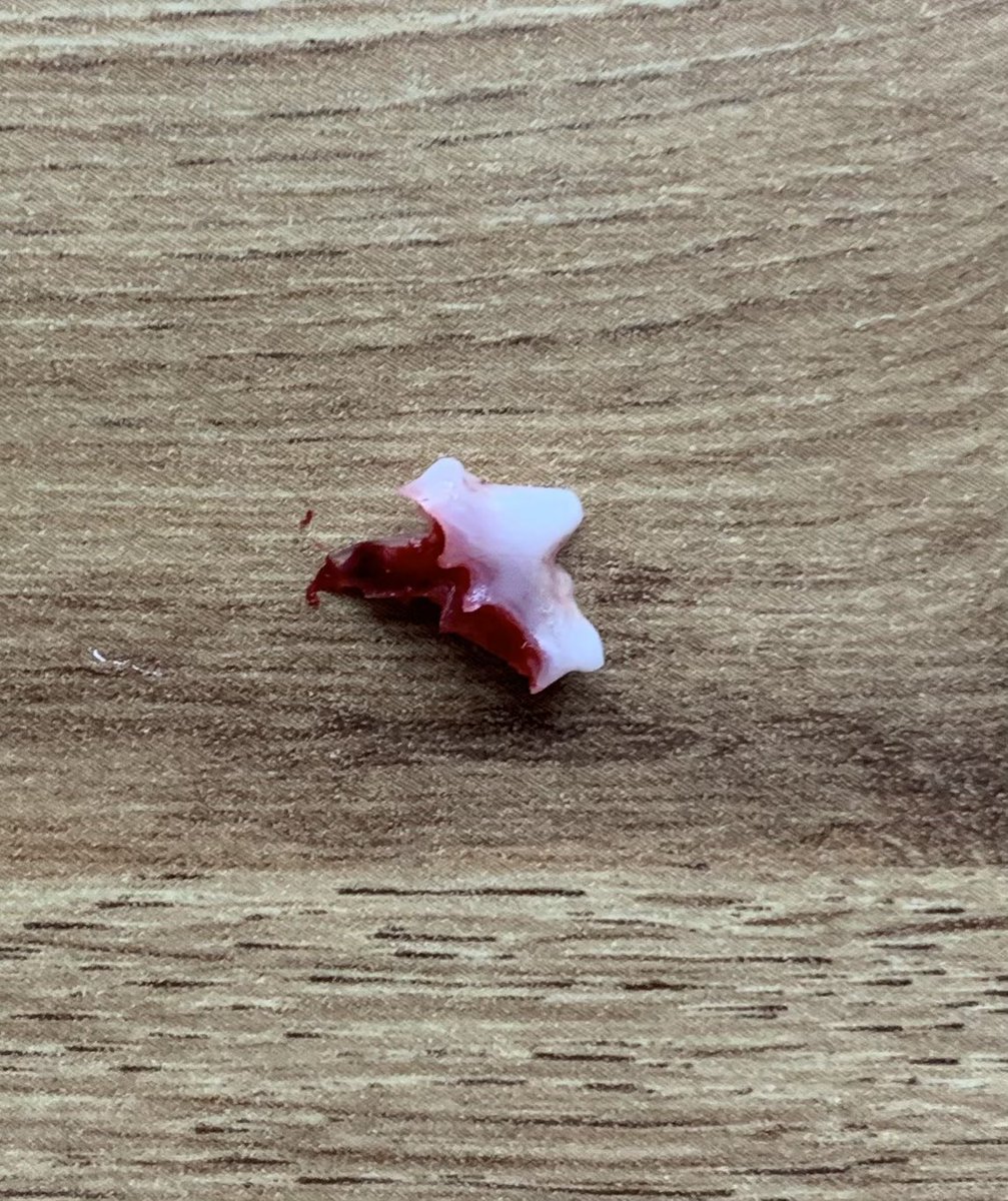 Me need a dentist! Anyone know a good one??