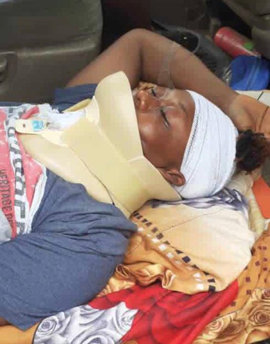 iamyhelay's tweet photo. She was said to have been involved in an accident along Lagos-Ibadan expressway on Monday. She's a close friend and a mother of 2. Please help save Morenike. #MorenikeMustSurvive https://t.co/Qtrh29gtAw