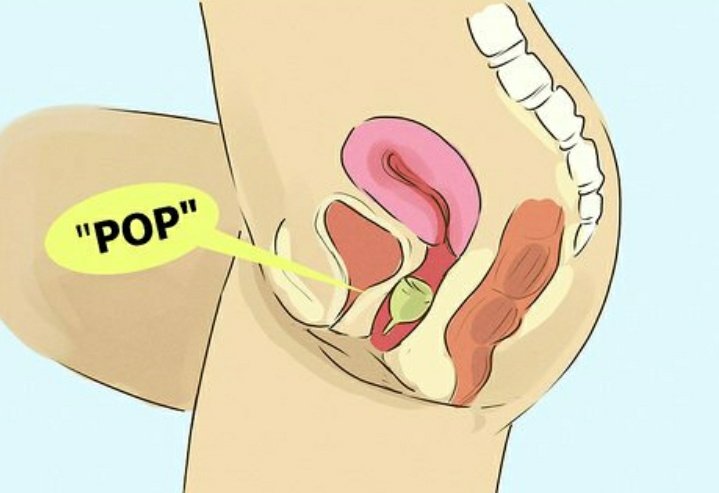 you use a menstrual cup by folding it (using a folding technique that is most comfortable for you) & inserting it much like you would a tampon. when it is inserted and you are sure that it has opened inside of you, you& #39;re good to go!!