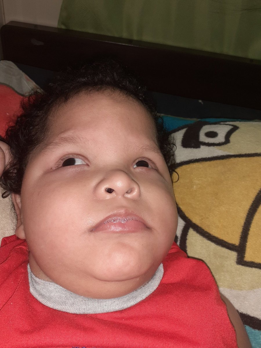 SEGIMOS COLECTANDO ESTAMOS LEJOS DE LA META
PUEDES HACER TU APORTE A LA CUENTA
 0411980553739 
BANCO GENERAL 
CTA DE AHORRO
YAPPY 67454107
DEREK NECESITA REALIZARSE UN EXAMEN IMPORTANTE EL CUAL TIENE UN COSTO DE 1,180BL 
EN LAS PUBLICACIONES ANTERIORES ESTA LA INFORMACION 
RT XF